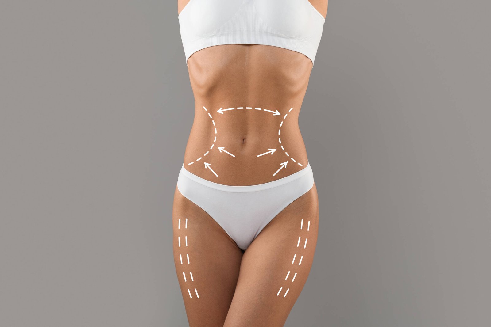 Tummy Tuck