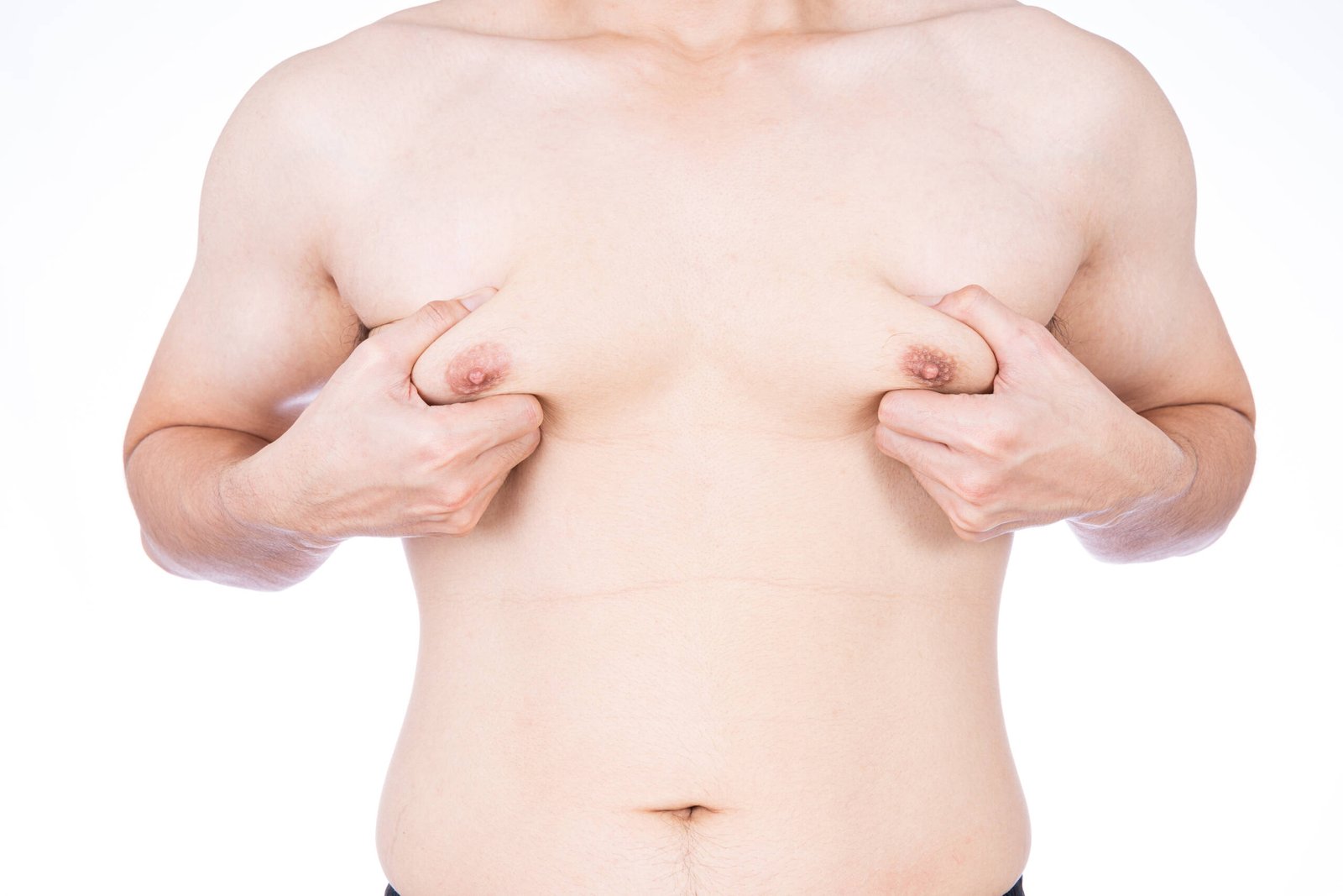 Gynaecomastia